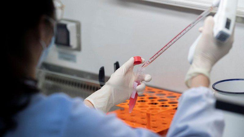 3 Estados já têm casos suspeitos de cepa indiana