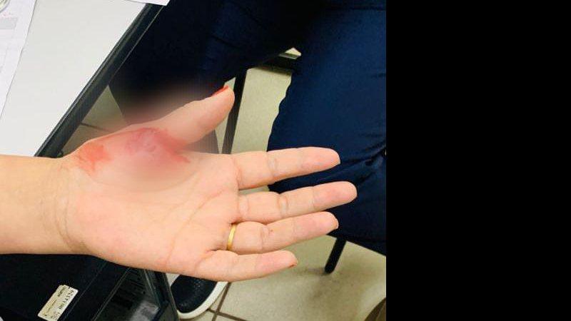 Técnica é mordida por jovem em UPA da Capital